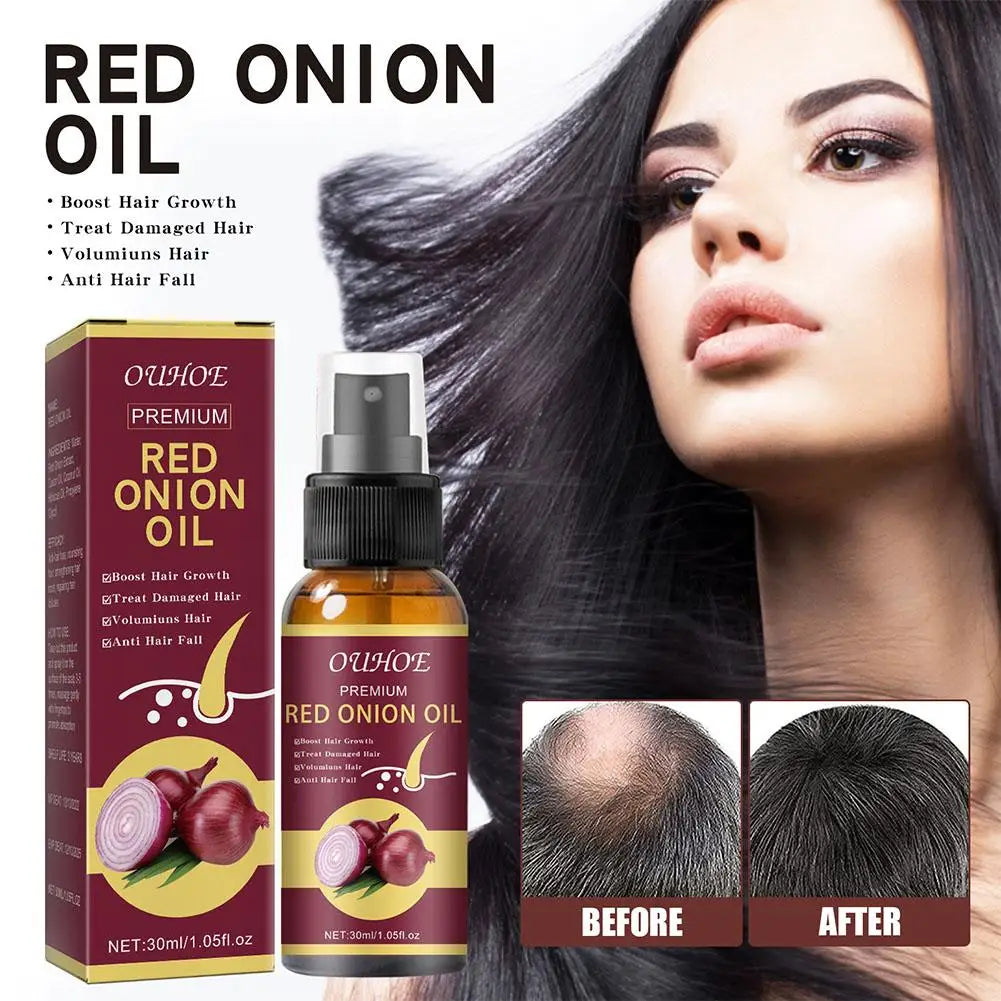 30ml Red Onion Products Black Seed Essential Oils Oil Spray For Hair Care And Growth To Prevent Hair Loss H2U9