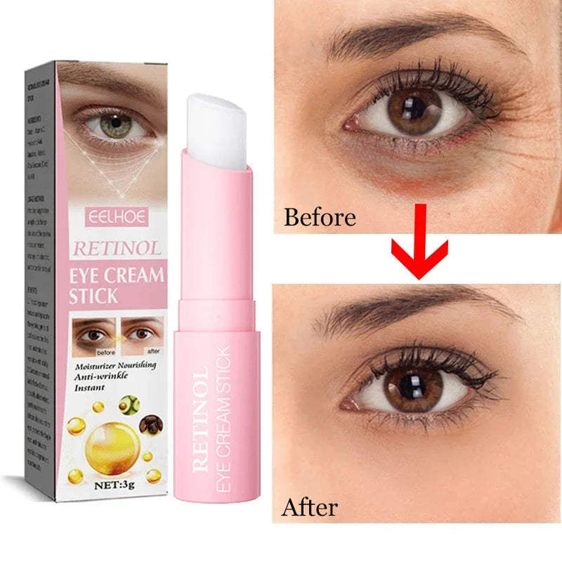 Retinol Eye Moisturising Stick Reduce Dark Circles Beauty Eye Care