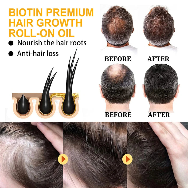 EELHOE Biotin Hair Serum For Man Women hair Growth Serum