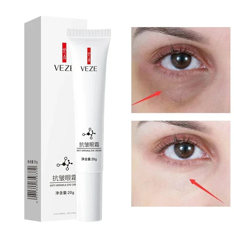 Nicotinamide Eyes Cream Dark Circles Hyaluronic Acid Moisturising Eye Care