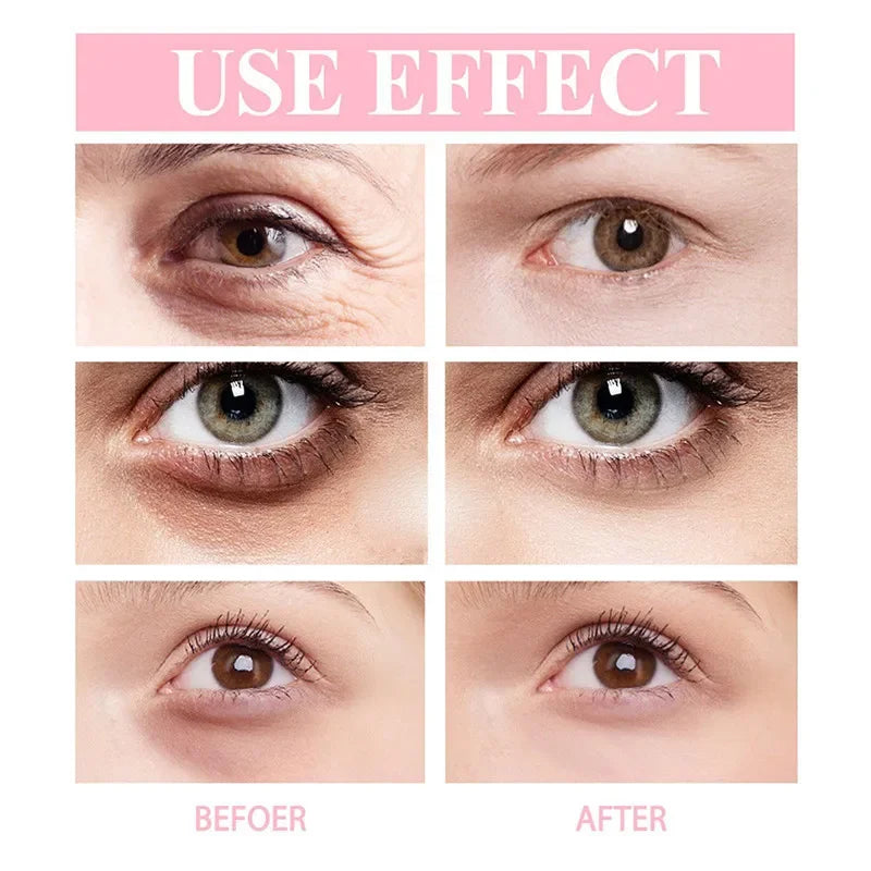 Retinol Eye Moisturising Stick Reduce Dark Circles Beauty Eye Care