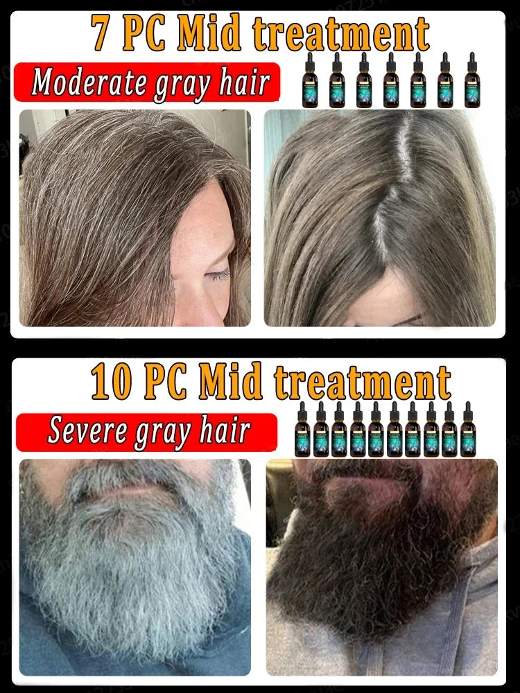 Anti-grey hair Serum treatment natural hair color and restore healthy White To Black hair