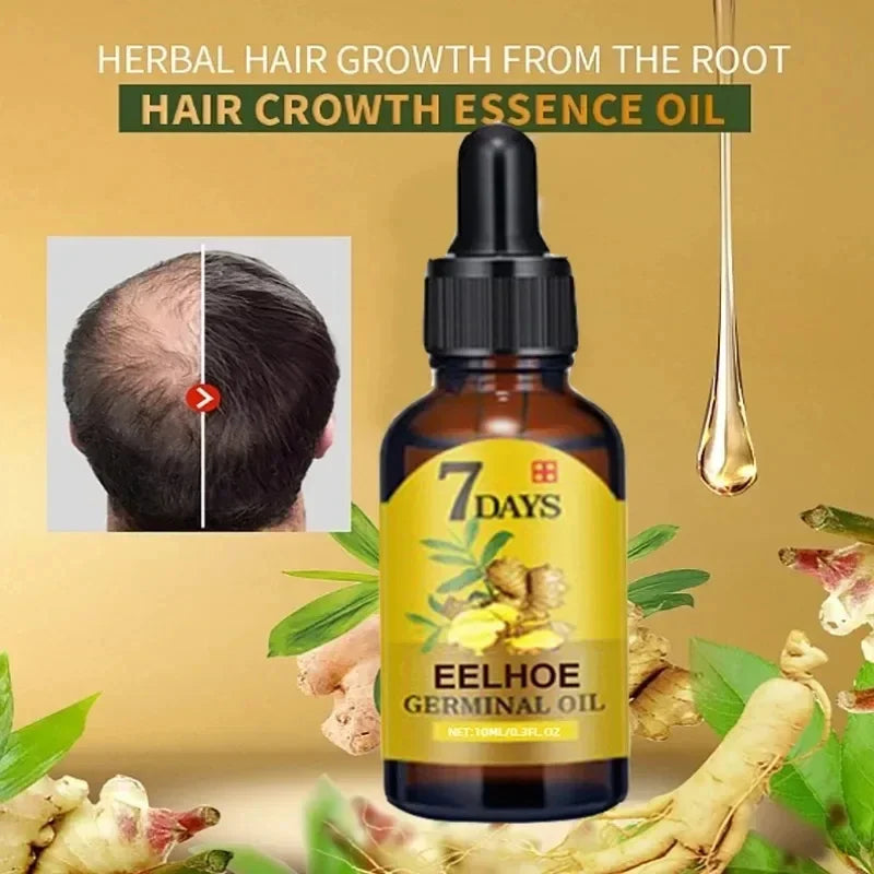 Hair Growth Essential Oil 10/20/40ml Prevent Hair Loss Liquid Dense Hairs Growth Serum Professional Hair Treatment Health Care