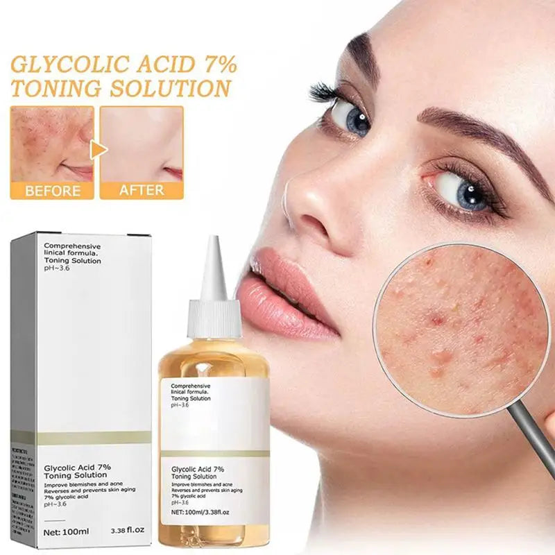 Glycolic Acid Toning Solution Lifting Wrinkles, Anti Acne Acid Toner