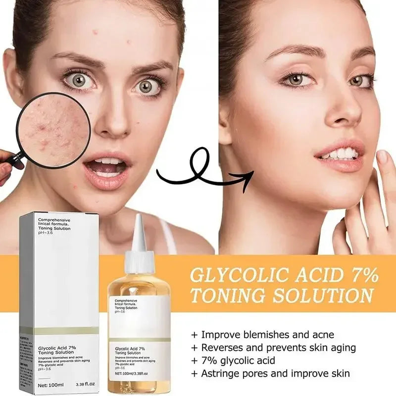 Glycolic Acid Toning Solution Lifting Wrinkles, Anti Acne Acid Toner