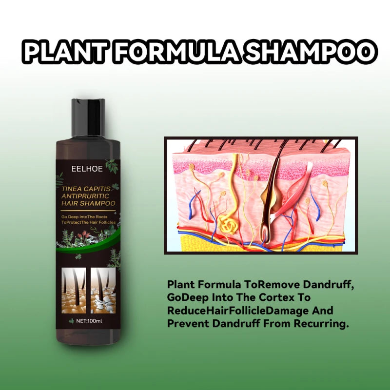 Psoriatic Seborrheic Dermatitis Shampoo Anti Dandruff For Remove Dandruff & Oil