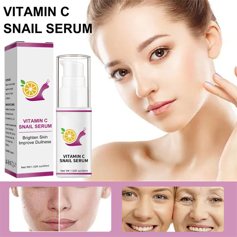 20ML Anti Redness Soluation ,Spider Vein Removal Advanced treatment Clearer skin Veins on Face