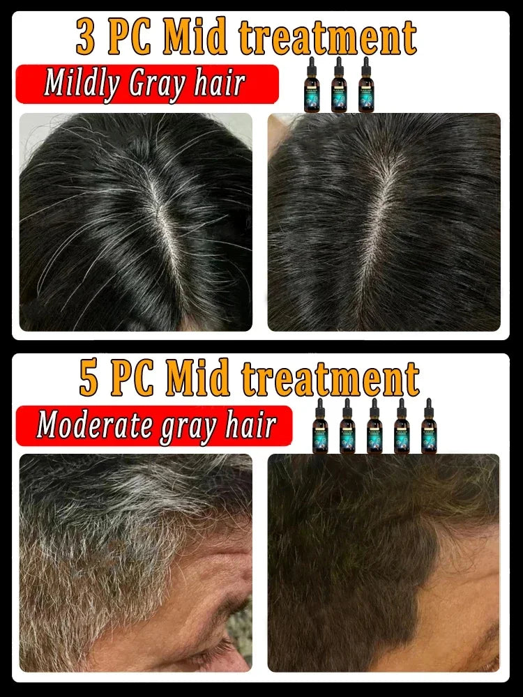 Anti-grey hair Serum treatment natural hair color and restore healthy White To Black hair