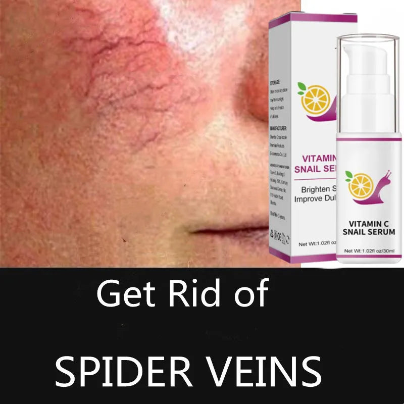 20ML Anti Redness Soluation ,Spider Vein Removal Advanced treatment Clearer skin Veins on Face