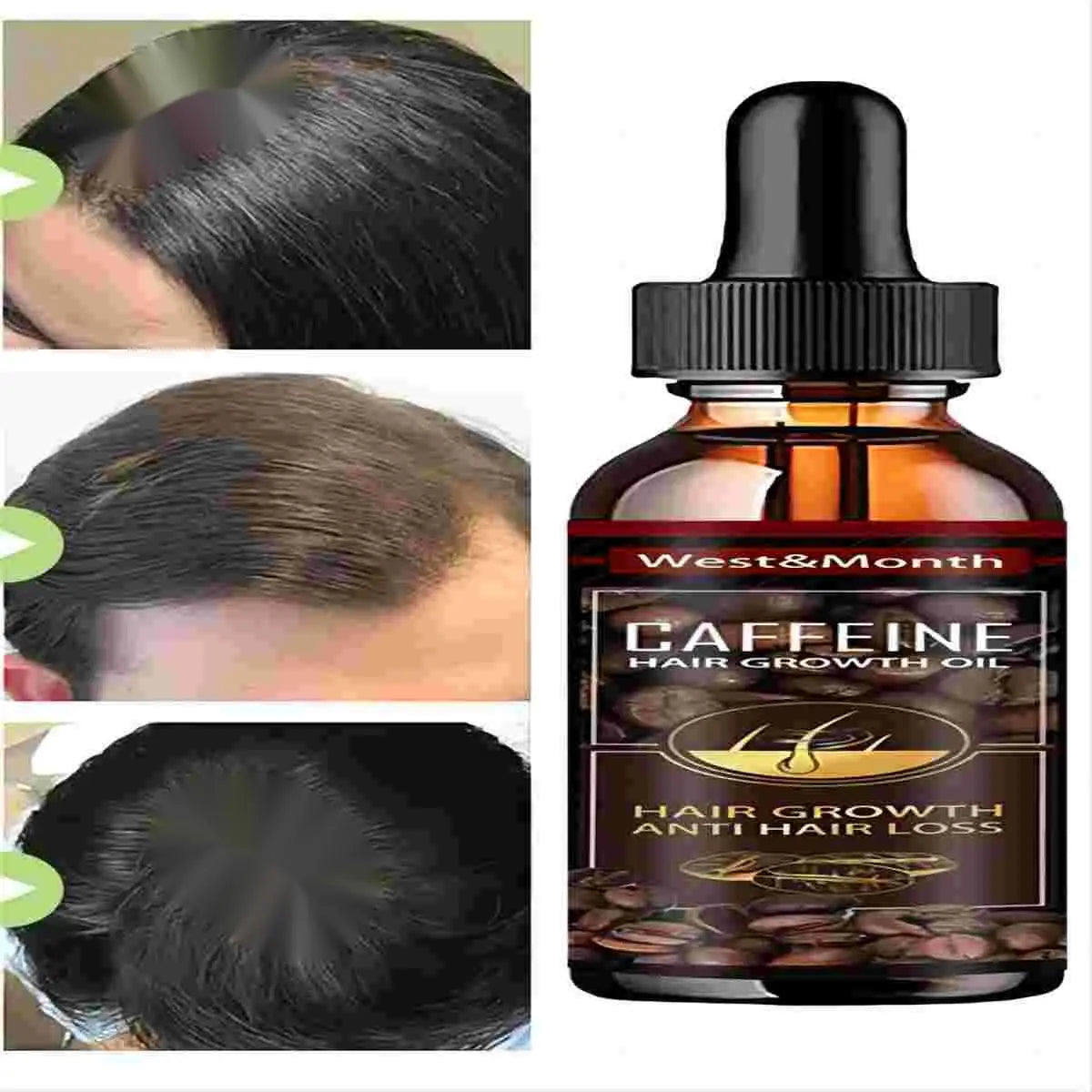 Alopecia Hair Treatment for Women Hairloss Hair Oil Growth Tool Spray Caffeine for Treatment Dry Frizzy Damaged Thin Hair Care