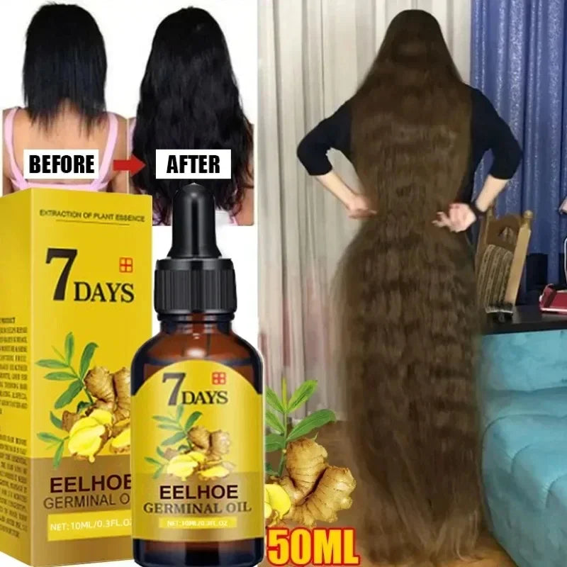 Hair Growth Essential Oil 10/20/40ml Prevent Hair Loss Liquid Dense Hairs Growth Serum Professional Hair Treatment Health Care