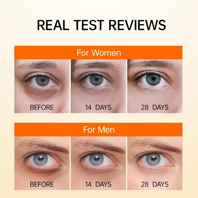 Eye Cream Remove Dark Circle Eye bags Firming Eye Skin Care Beauty